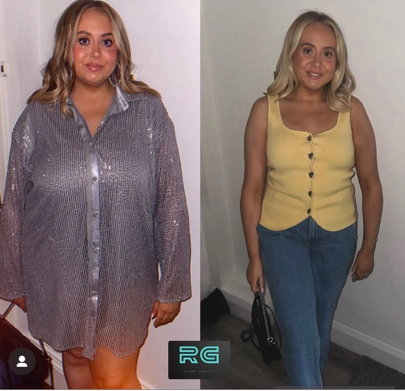 Ross Gaffney client transformation — before and after